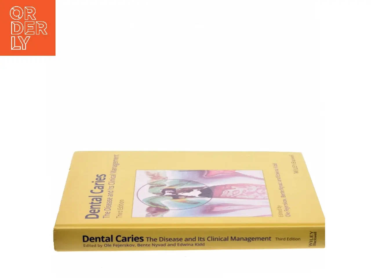 Billede 2 - Dental caries : the disease and its clinical management (Bog)