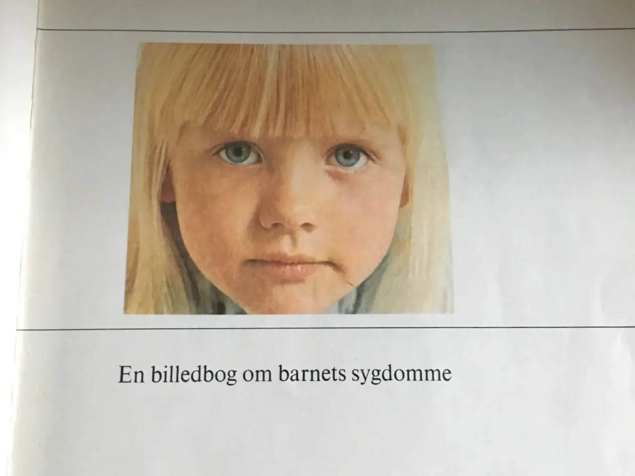 Billede 1 - Det gør ondt mor