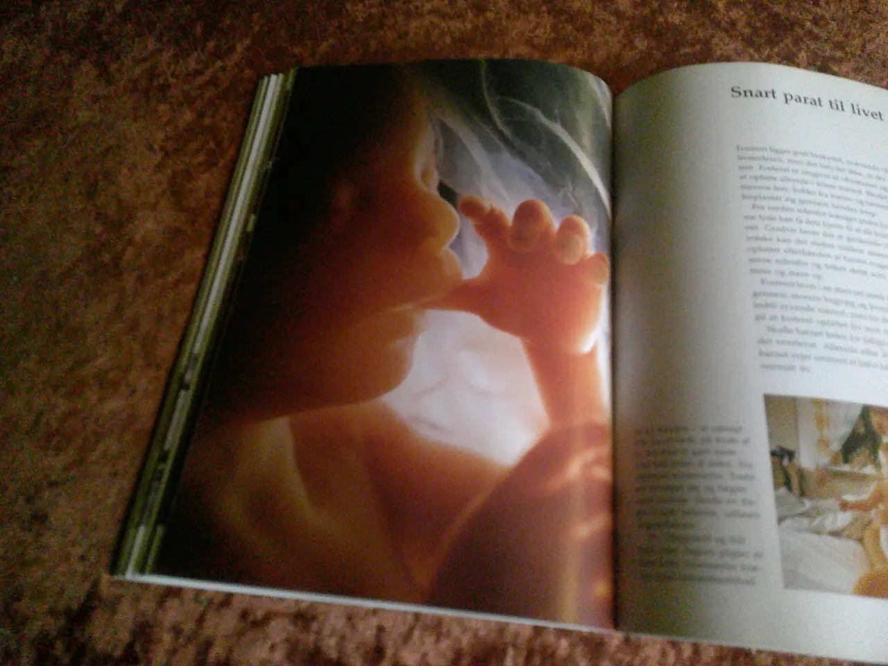 Billede 3 - Et barn bliver til, Lennart Nilsson, m.fl.