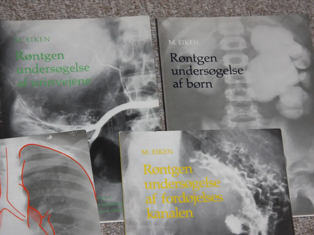 Billede 3 - Røntgenundersøgelse af thorax