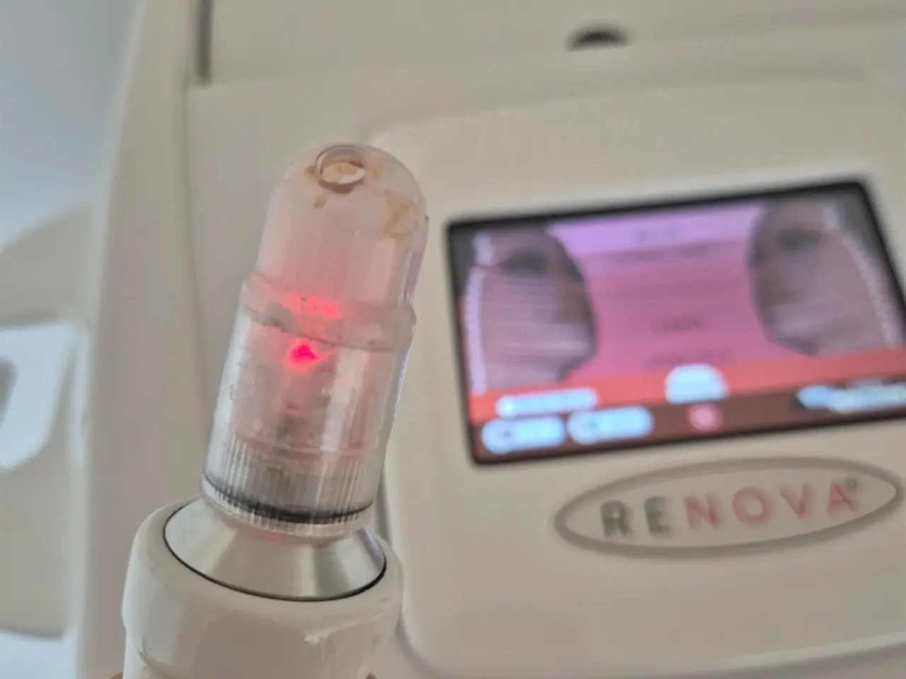 Billede 9 - Biotec Italia RENOVA beauty maskine