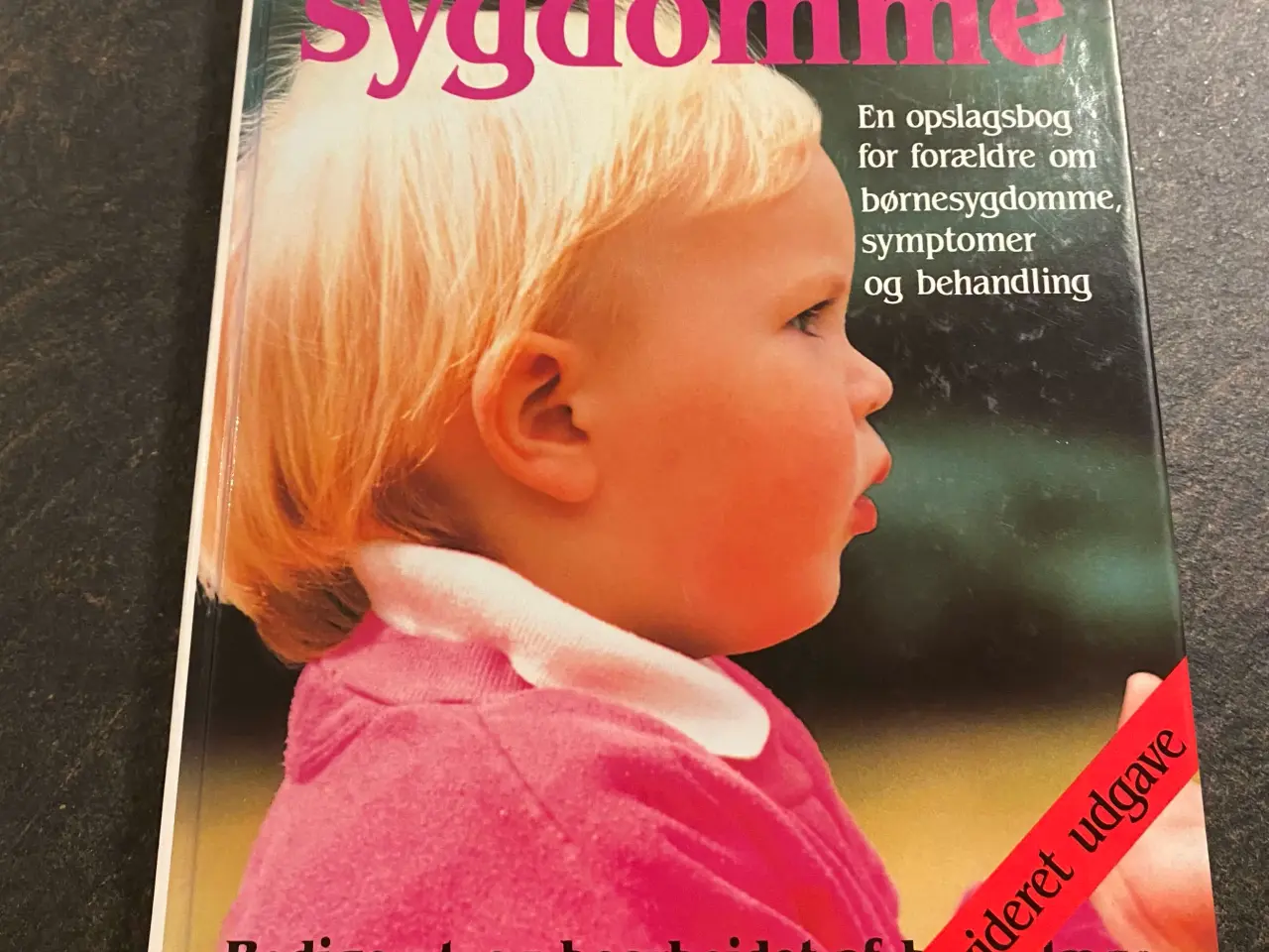 Billede 1 - Barnets sygdomme