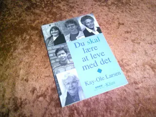 Du skal lære at leve med det, Kay-Ole Larsen