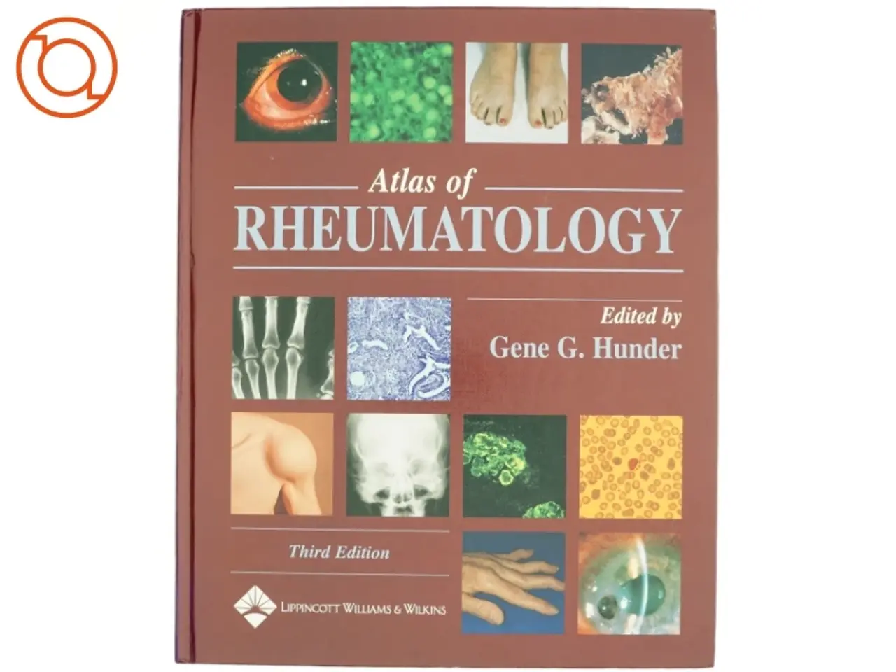 Billede 1 - Atlas of Rheumatology af Gene G. Hunder (Bog)