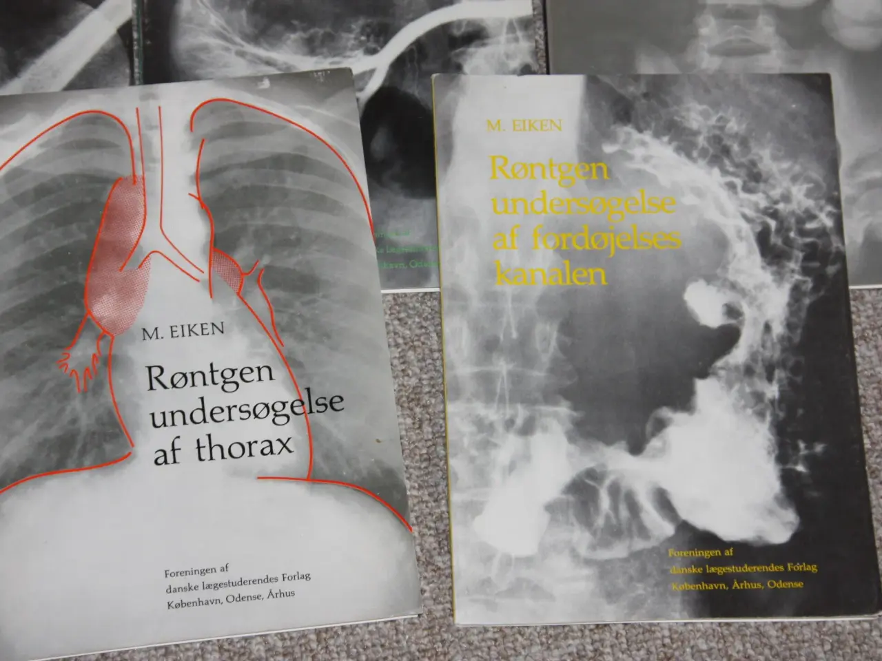 Billede 4 - Røntgenundersøgelse af thorax