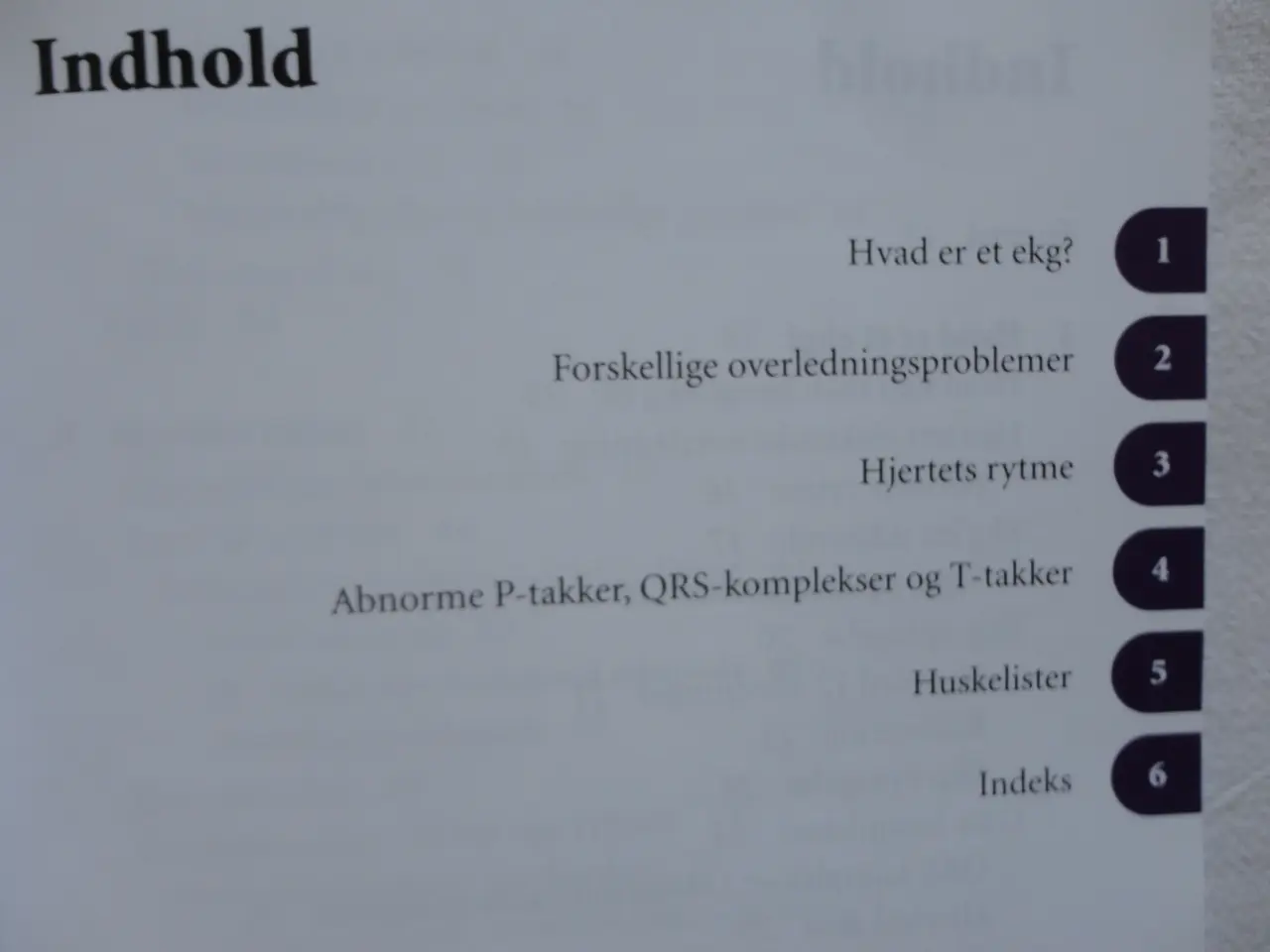 Billede 2 - EKG  -  let at se  :