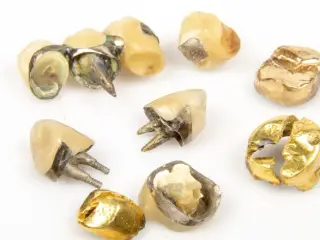 Guld tænder købes