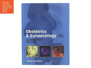 Obstetrics and Gynaecology by Tim, Impey, Lawrence Child af Lawrence Impey (Bog)