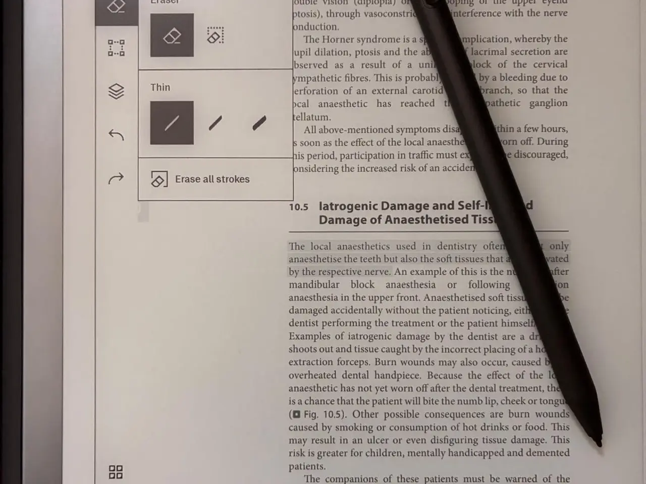 Billede 7 - reMarkable 2 med pen og etui