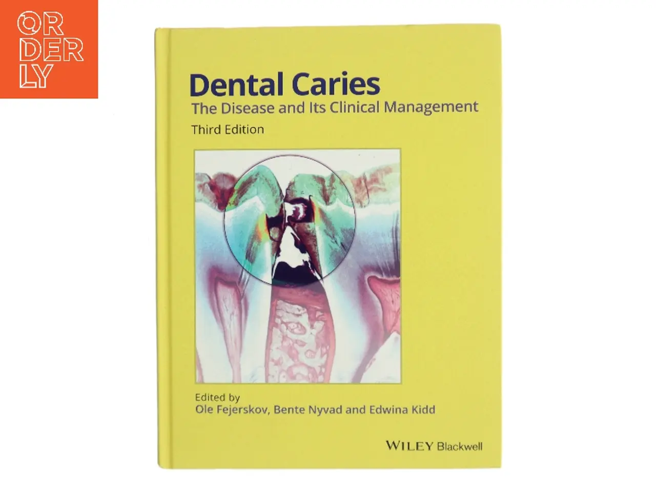 Billede 1 - Dental caries : the disease and its clinical management (Bog)