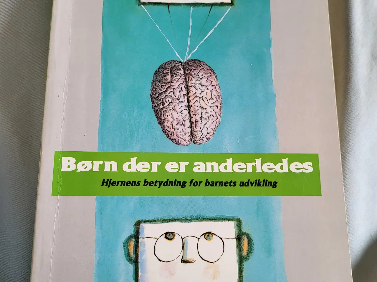 Billede 1 - Børn der er anderledes