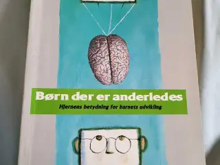 Børn der er anderledes