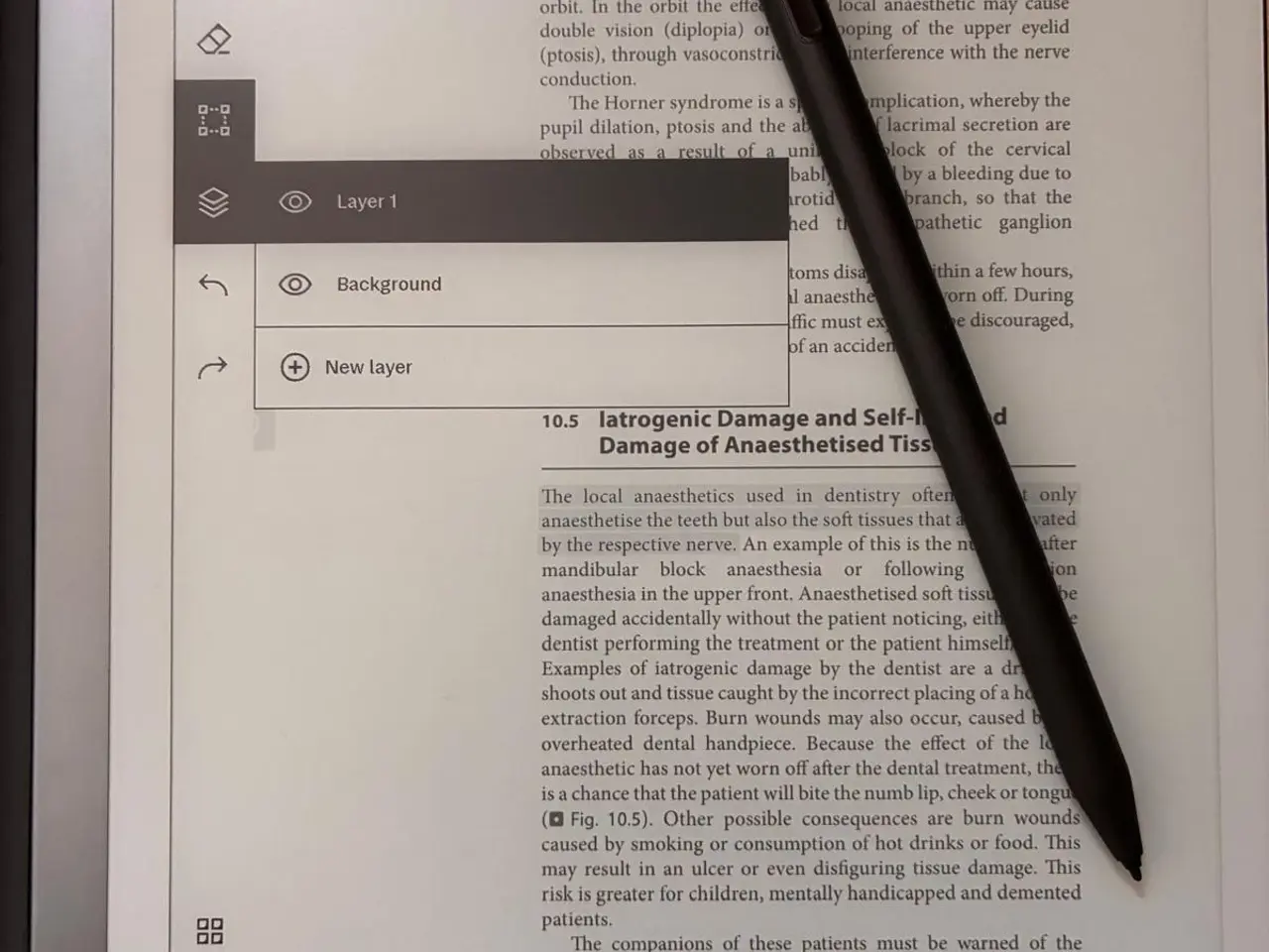 Billede 6 - reMarkable 2 med pen og etui