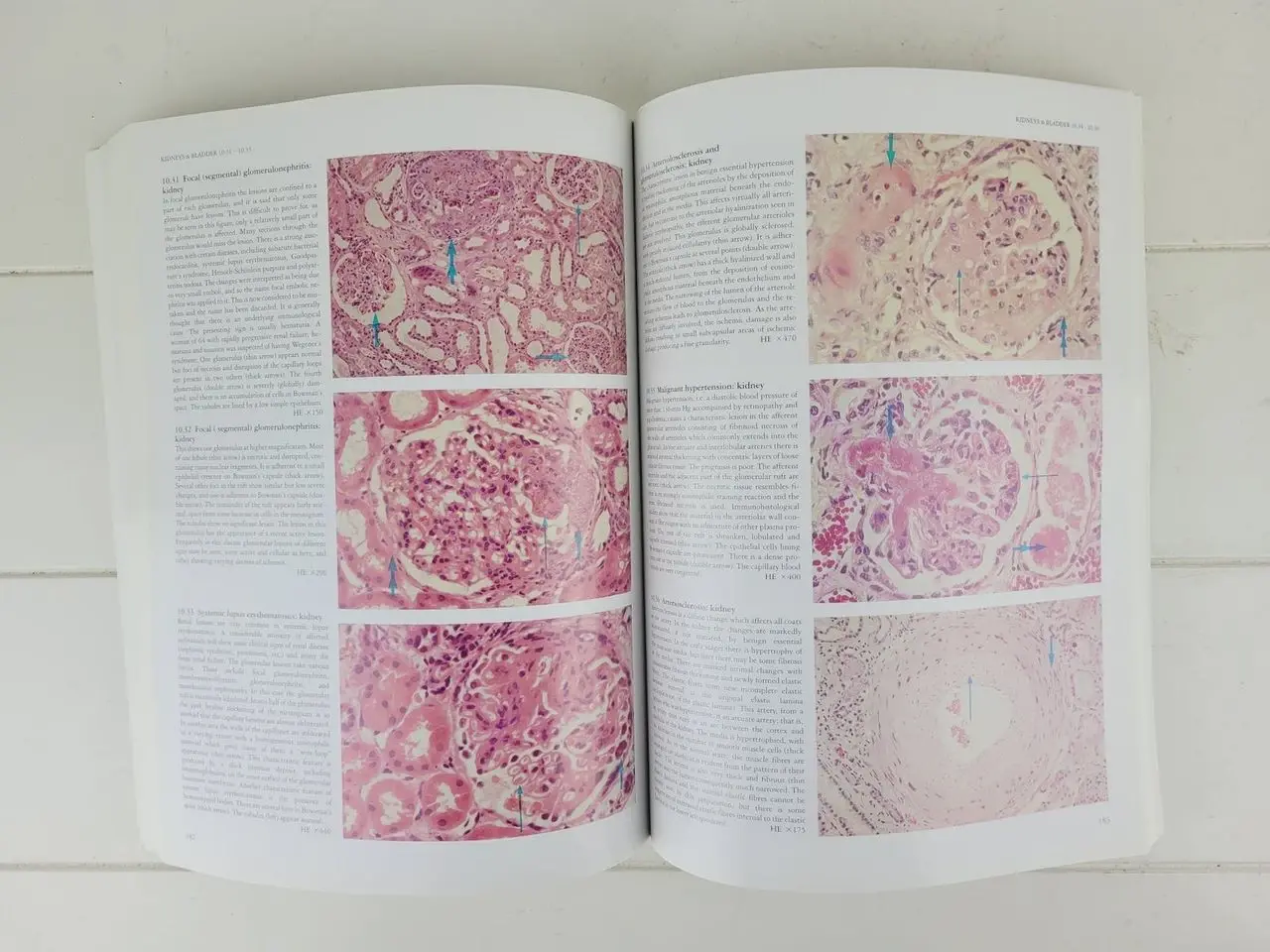 Billede 6 - Curran’s Atlas of Histopathology – 4. udgave