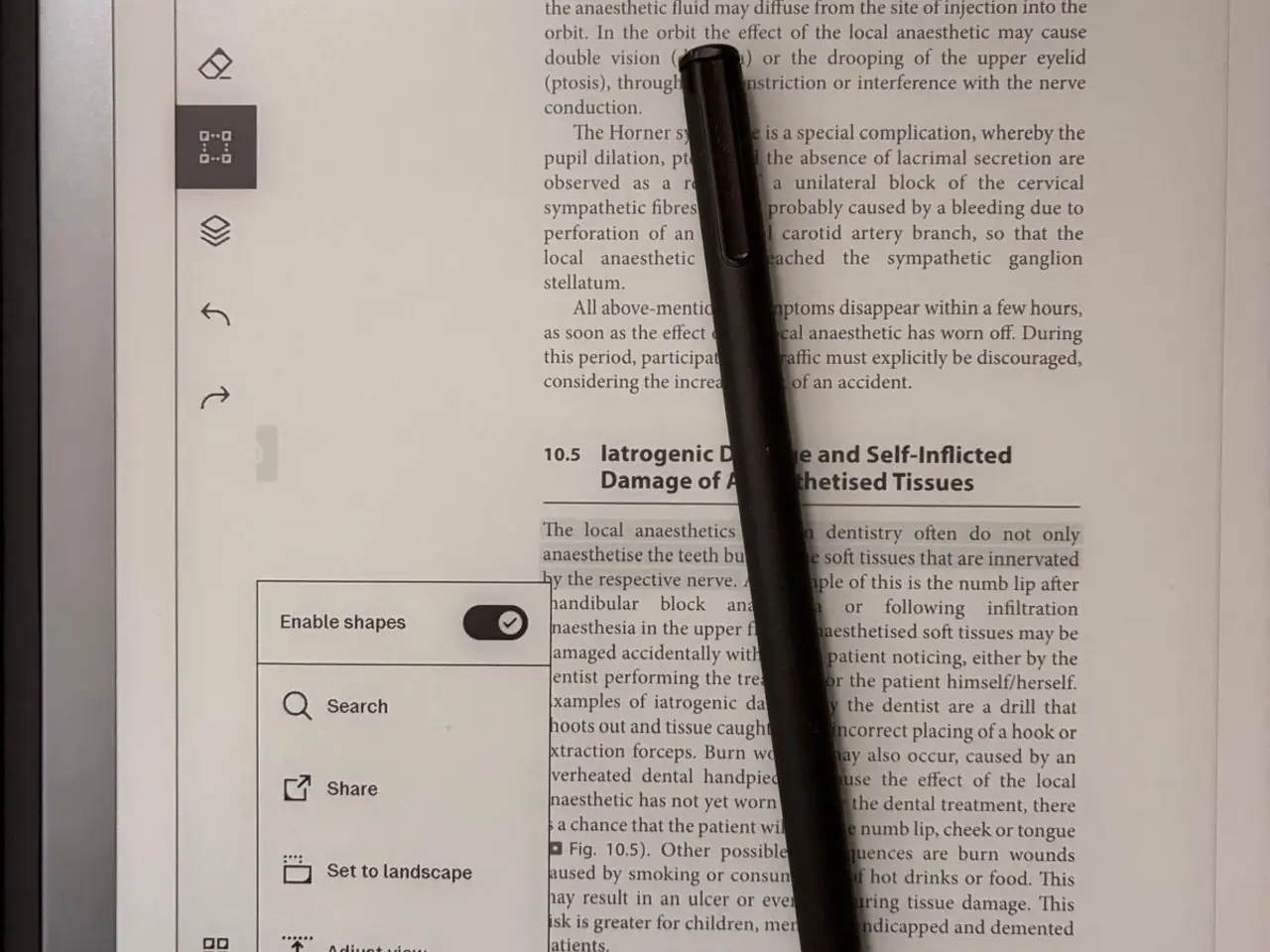 Billede 4 - reMarkable 2 med pen og etui