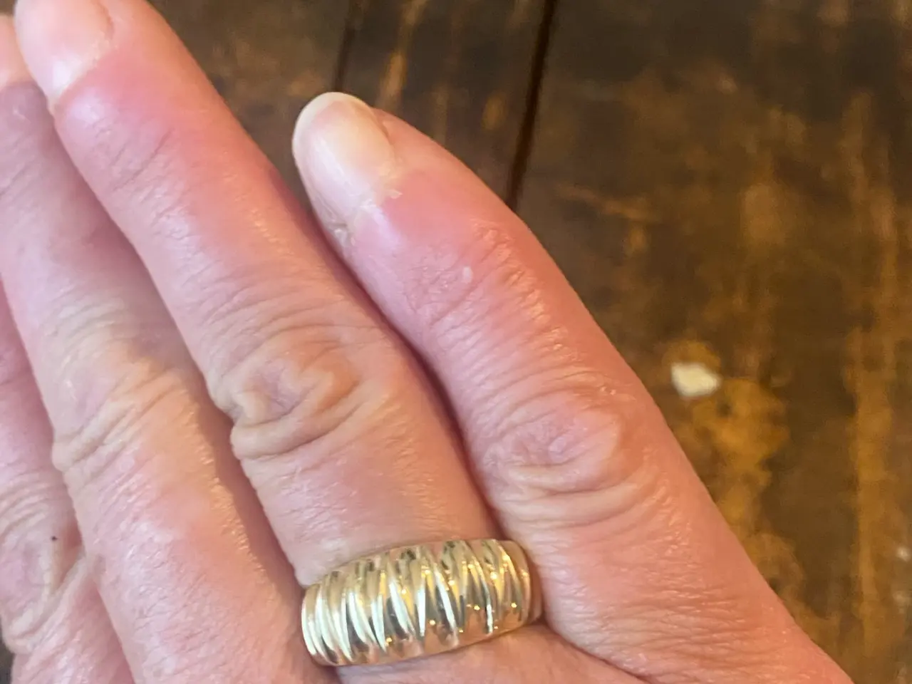 Billede 2 - Guldring 