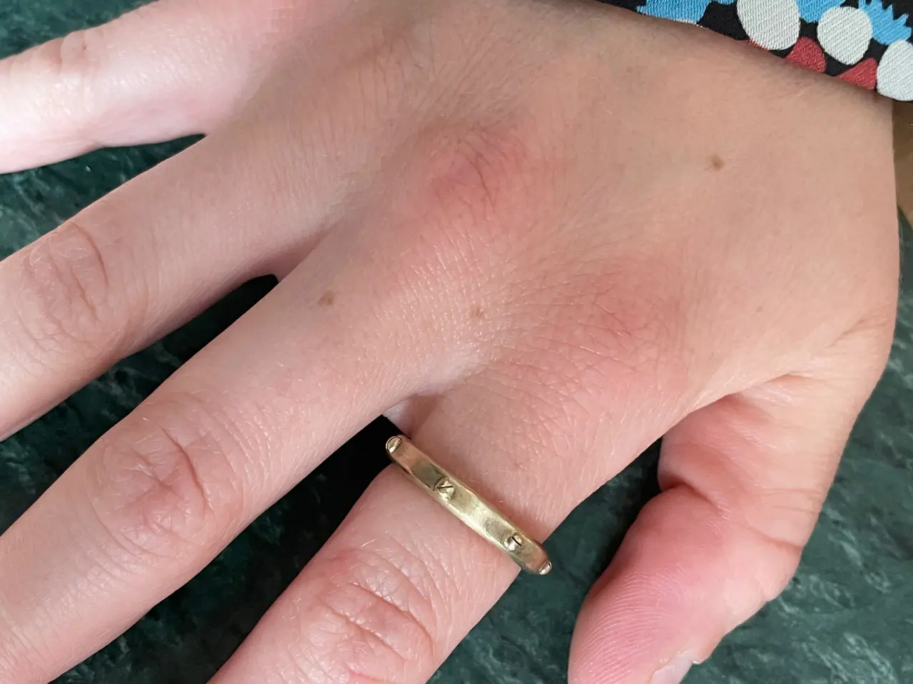 Billede 9 - Jane Kønig forgyldt ring med skruer